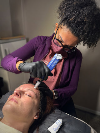 skinpen-microneedling-vancouver-Washington