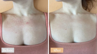 Omnilux Contour Neck & Décolleté