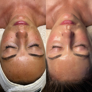 pigment-results-skincare-facial-vancouver-washington
